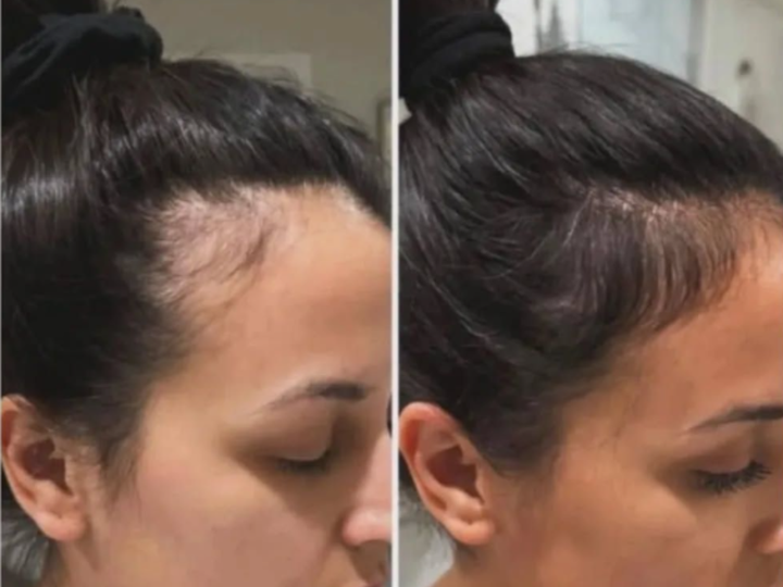 Rosaura, 36 años